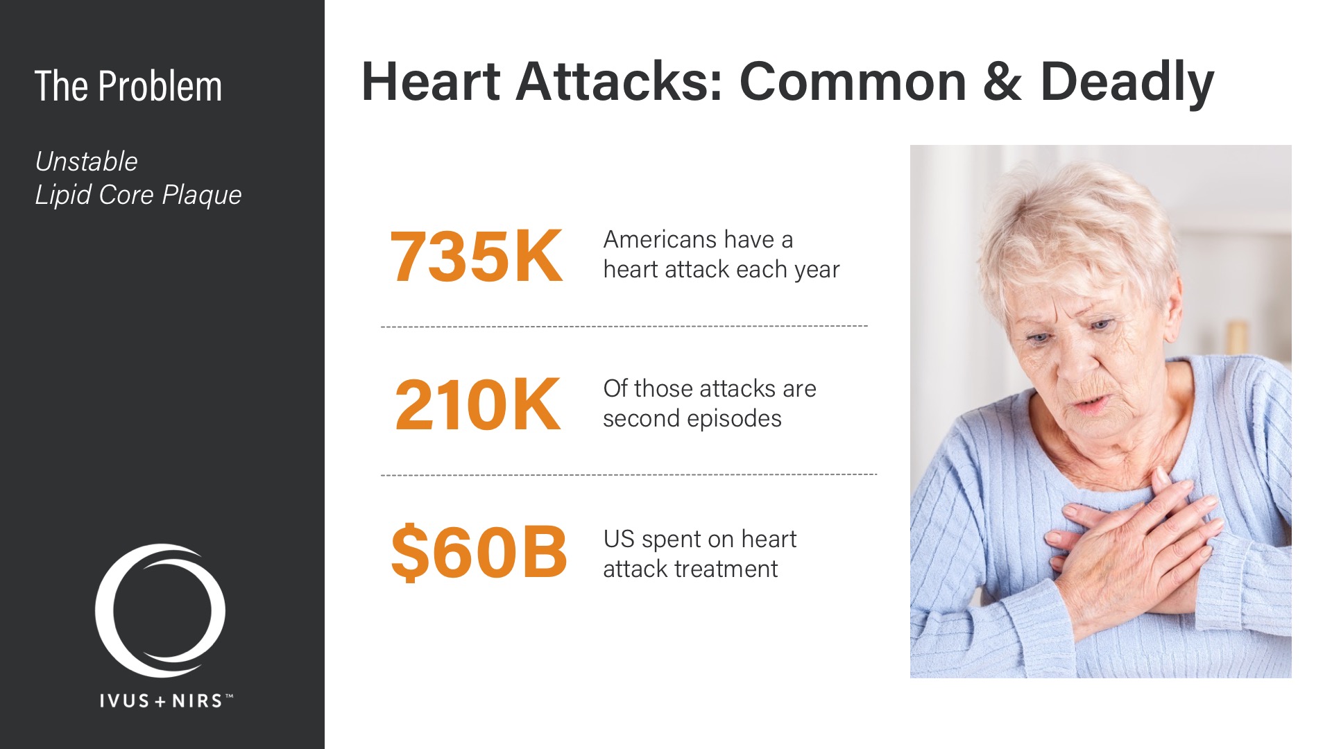 Infraredx Corporate Deck - Problem - Heart Attacks: Common & Deadly